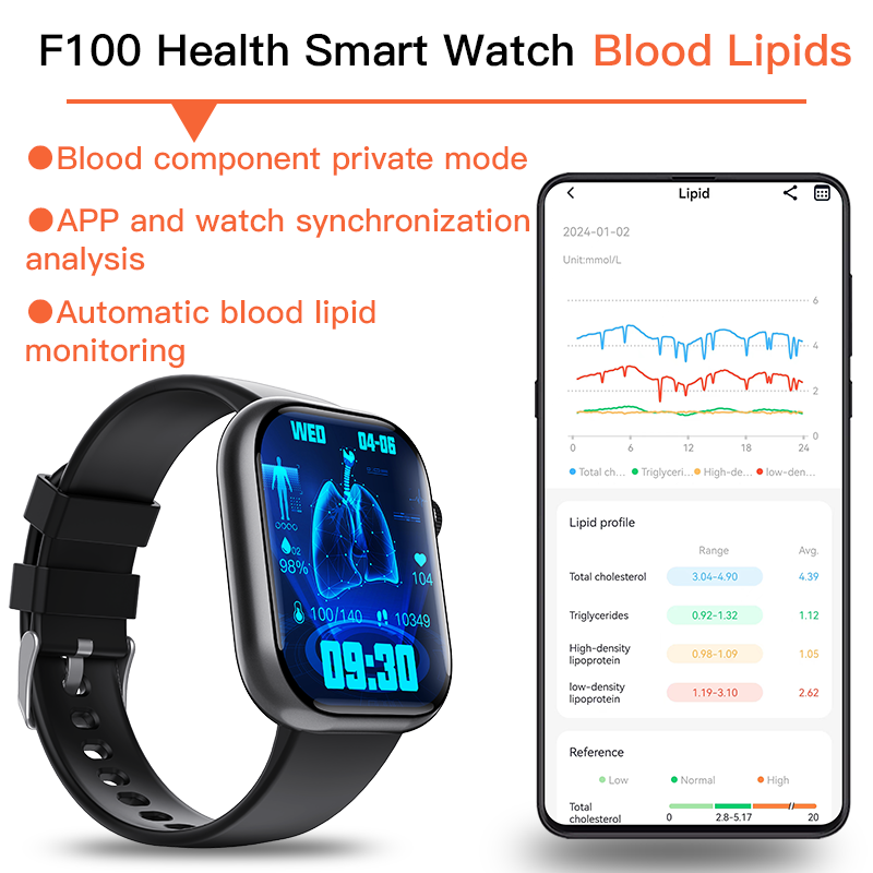 Best ECG Smart Watch of 2025 With Blood Pressure Monitor+Blood Glucose Monitoring